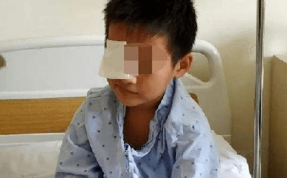 Cậu bé 10 tuổi suýt bị mù vì thói quen dùng thuốc nhỏ mắt mà nhiều bố mẹ vẫn làm
