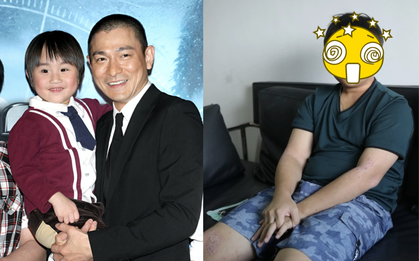 Sao nhí 2 tuổi đã nổi tiếng khắp châu Á nhưng bị bố coi là “cỗ máy in tiền”, cuộc sống hiện tại thay đổi 180 độ