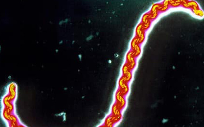 Ghi nhận 2 trường hợp nhiễm xoắn khuẩn vàng da tại Bà Rịa - Vũng Tàu