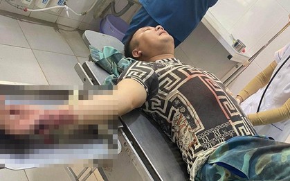 Gã đàn ông "bắt sâu" trên ngực vợ hàng xóm, chém chồng trọng thương