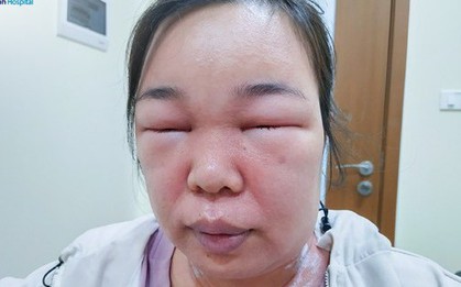Sau thoa mỹ phẩm, người phụ nữ phải đi xe lăn