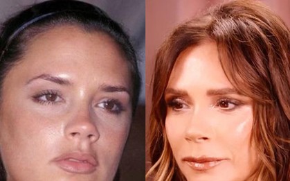 Thủ thuật đánh lừa của Victoria Beckham
