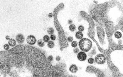 Anh ghi nhận 3 trường hợp mắc sốt Lassa mới, trong đó có 1 ca tử vong