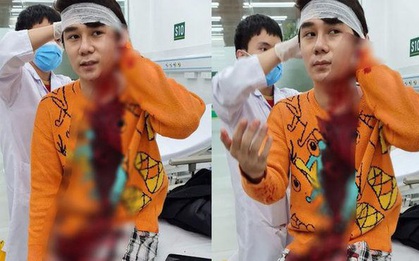 Nam diễn viên trong phim "Thương ngày nắng về" bị chém nhiều nhát vào người