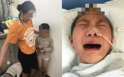 Con trai bị dì ghẻ liên tục bạo hành dã man, hành động của bố mẹ ruột đứa trẻ khiến dân tình không thể ngồi yên