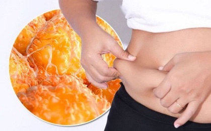 Loại mỡ này bao quanh các cơ quan trong bụng gây bệnh tiểu đường, bệnh tim, gan nhiễm mỡ, làm được 4 việc sẽ không còn lo nữa
