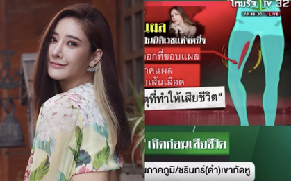 Cảnh sát đưa ra kết luận quan trọng về vết thương bị nghi là nguyên nhân gây ra cái chết cho nữ diễn viên Chiếc Lá Bay