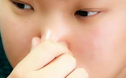 Người gan kém thường có 4 biểu hiện bất thường ở quanh miệng, nếu bạn không có thì xin chúc mừng