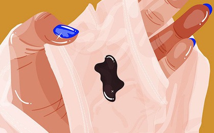 Có virus HPV trong cổ tử cung, nữ giới sẽ gặp phải tình trạng "1 hôi và 2 đen" khá nghiêm trọng