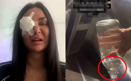 Ngôi sao TikTok bị tạt axit khi đang phát trực tiếp, hàng ngàn người xem nghe rõ tiếng la hét hoảng loạn, cầu xin nước để đỡ bỏng rát