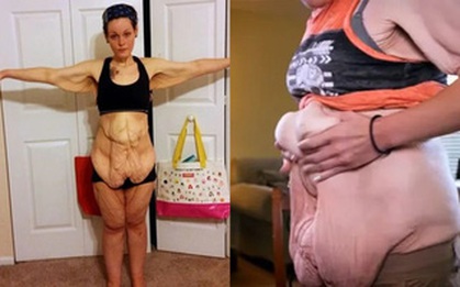 Quyết tâm giảm 152kg để con gái tự hào, người phụ nữ hối hận với cơ thể dị hợm và màn biến hình khó tin sau đó