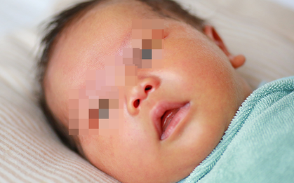 Viêm gan bí ẩn ở trẻ em khiến nhiều bố mẹ hoang mang: Bác sĩ gan mật giải thích cặn kẽ