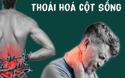 3 thói quen thường gặp là "vua bào mòn" cột sống: Bác sĩ cảnh báo đau âm ỉ kéo dài ở 2 vùng này thì phải khám ngay kẻo muộn