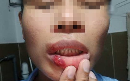 CLIP: Tài xế xe công nghệ bị tấn công dã man trước Bến xe Miền Tây