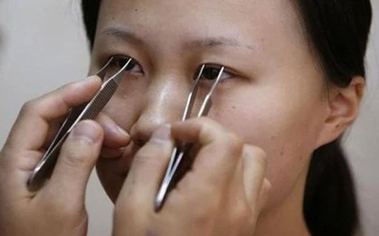 "Tiền mất tật mang" vì muốn có đôi mắt "như mơ"