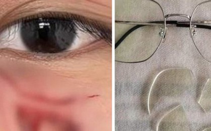 Đấm học sinh khâu 16 mũi, thầy giáo ở Trung Quốc bị sa thải