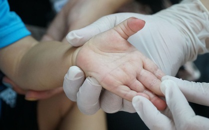 Hà Nội: Nắng nóng, người già, trẻ em và người mắc tay chân miệng nhập viện tăng