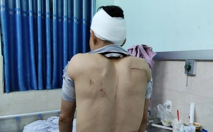 Nhóm côn đồ mang dao kiếm vào cổng bệnh viện, hành hung người dân
