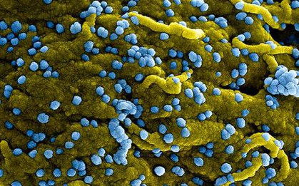 WHO tuyên bố đợt bùng phát loại virus mới