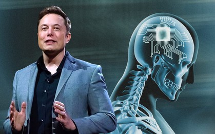 Elon Musk đã "copy" thành công não của chính mình