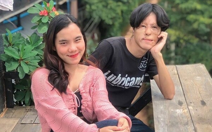 "Tình yêu cổ tích" của chàng trai có gương mặt biến dạng