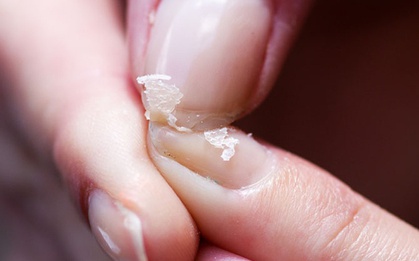 3 triệu chứng bất thường ở bàn tay ngầm cảnh báo gan có vấn đề, nếu có thì nên đi khám ngay