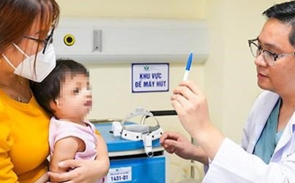 Bé gái 10 tháng tuổi mắc dị tật sọ mặt hiếm gặp