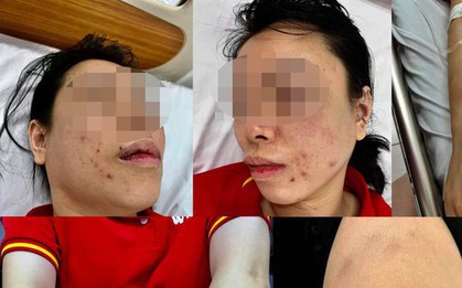 Người phụ nữ tố bị chồng cũ "bắt cóc" tra tấn dã man: Nhốt trong ô tô, đánh từ Hà Nội lên Hòa Bình
