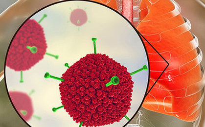 Virus Adeno mà nhiều trẻ đang nhiễm phải nguy hiểm ra sao?