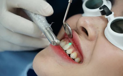 Muốn răng đẹp nhưng không có thời gian đi niềng, sợ kết quả "hên xui" thì làm ngay 1 việc!