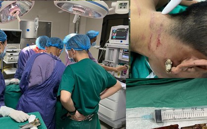 Phú Thọ: Cứu sống nam thanh niên bị thanh tre đâm xuyên cổ