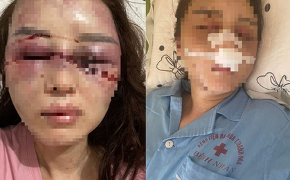 Kết quả điều tra cán bộ QLTT đánh bạn gái dã man vì hát song ca với người khác