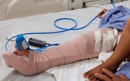 Ô tô chở khách đi chùa gây tai nạn khi xuống dốc, 2 người thương vong
