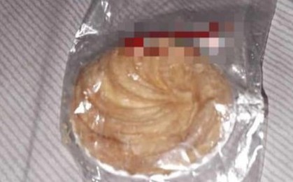 Bé 6 tuổi ngộ độc sau tiệc Trung thu: Lập hội đồng đánh giá quy trình tiếp nhận