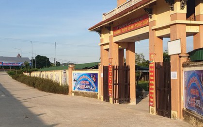 Xô xát với bạn giờ ra chơi, nam sinh bị ngã nứt xương sọ não