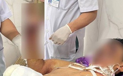 Mất mạng, cụt tay chân, mù mắt... vì pháo