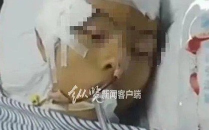 Nam sinh cấp 2 bị bạn đánh tới mức sống thực vật