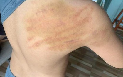 TP Tuy Hòa nói gì về 1 học sinh tiểu học bị đánh do không làm được bài tập?