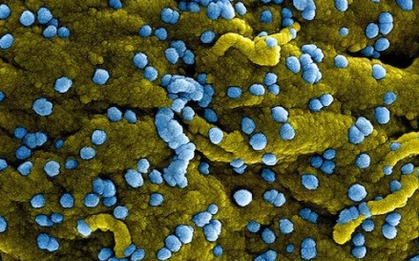Virus Marburg gây sốt xuất huyết nguy hiểm thế nào?
