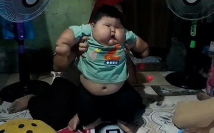 Cuộc sống của cậu bé "khổng lồ"16 tháng tuổi đã nặng 27kg, không thể tự đứng thẳng hay bước đi, mặc đồ của bố mới vừa