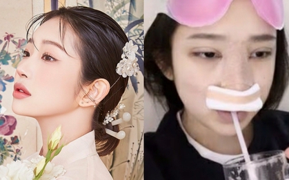 Con gái nữ minh tinh quá cố Choi Jin Sil công bố loạt ảnh ngay sau khi phẫu thuật thẩm mỹ: Bày tỏ sự hối hận?
