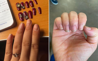 Sự thật ''kinh hoàng'' dưới những bộ nail xinh lung linh của hội chị em