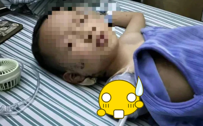 "Mẹ ơi, con đau chết mất" - cậu nhóc 7 tuổi đang chơi trước nhà thì gặp sự cố phải cắt cụt 1 tay, bóng ma tâm lý đi theo suốt đời vì sai lầm của hàng xóm
