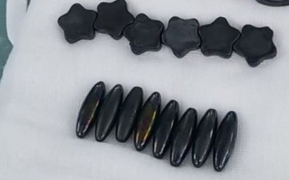 Bé trai nuốt 20 viên nam châm vì nghĩ là kẹo