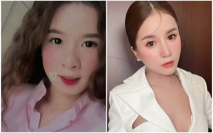Dung nhan trước khi phẫu thuật thẩm mỹ của Bà Nhân Vlog