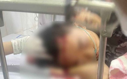 Hai nhóm gồm 40 trai làng lao vào nhau hỗn chiến kinh hoàng