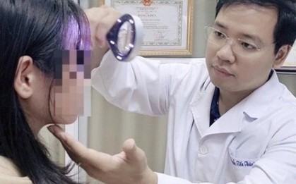 Học TikTok đun nước lá trị nám, 4 phụ nữ mặt loang lổ sau một đêm