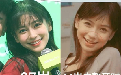 Angelababy sở hữu nhan sắc bao năm không đổi nhờ tip niềng răng đặc biệt