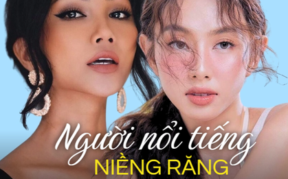 Những nàng hậu chỉ sửa "góc con người" mà nhan sắc lột xác ngoạn mục, có người trước - sau "khác biệt" hoàn toàn