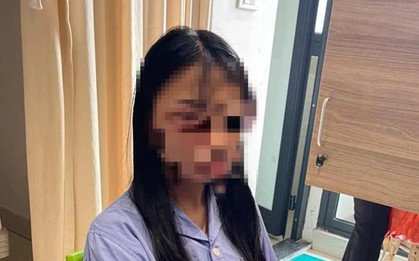 Công an giám định thương tích nữ sinh lớp 8 ở Hà Nội bị đánh hội đồng